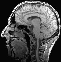 And this is my brain